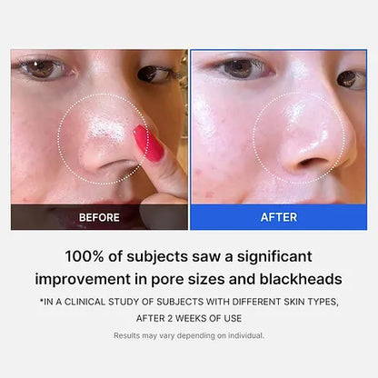 Medicube - Zero Pore Toner Pads